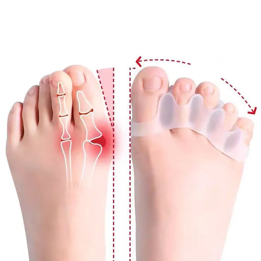 2PCS Séparateurs de orteils en Silicone - Correcteur d’Hallux Valgus et Dédoublage